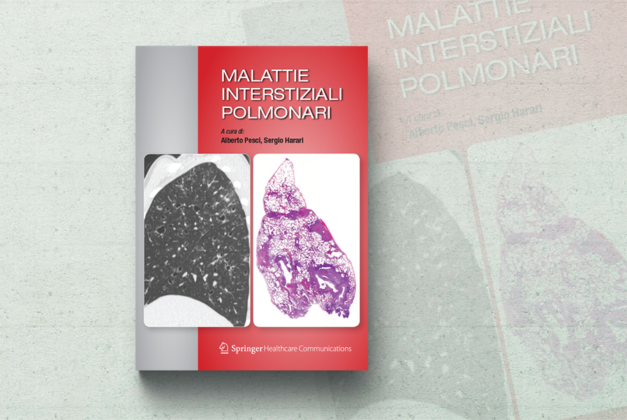 Malattie interstiziali polmonari: nuovo volume - IlPolmone.it