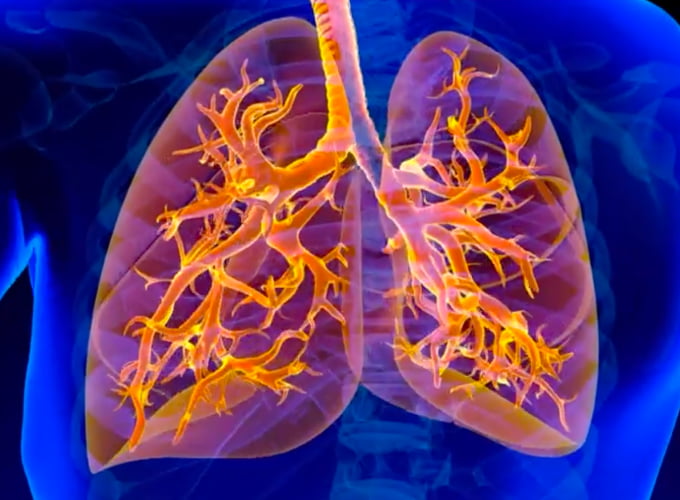 Grafica dei polmoni con bronchi evidenziati, simbolo delle malattie respiratorie e della broncopneumopatia cronica ostruttiva.